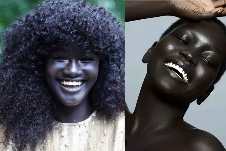 blackest person in the world